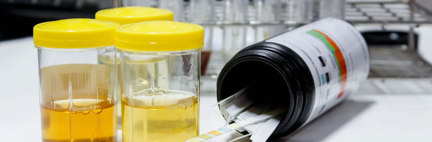 Hematuria Treatments