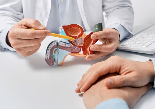 Benign Prostatic Hyperplasia (BPH)